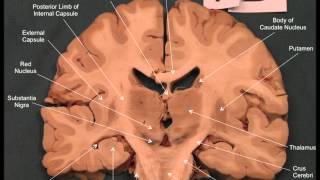 Neuroanatomy  Coronal Brain Slices [upl. by Eadahs881]