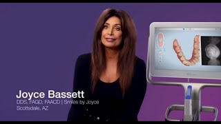 Joyce Bassett DDS FAGD FAACD on the iTero Element® 5D imaging system [upl. by Pauletta]