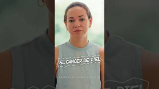 LaLesiónMásPeligrosa el Cáncer de Piel  Testimonio de Giuliana Nagaro [upl. by Aihsenat]