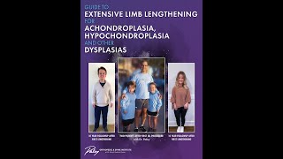 Extensive Limb Lengthening for Achondroplasia Hypochondroplasia and other Dysplasias [upl. by Dalis]