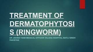 TREATMENT OF DERMATOPHYTOSISRINGWORM [upl. by Greenland]