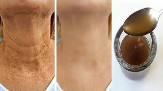 DIY Magical Antiaging Oil  Fight Pigmentation Spots  Reduce Wrinkles [upl. by Snevets238]