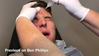 Ben Phillips Pranks Ive basically been pranked wow [upl. by Lapotin]