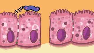 Pathogenesis of Opisthorchis viverrini and Helicobacter pylori coinfection [upl. by Aeila]