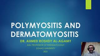 8 PolymyositisDermatomyositis PMDM [upl. by Figone701]