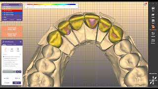 dentalsoftware installdentalsoftware exocad exoplan 3shape inlab cerec [upl. by Akcirederf]