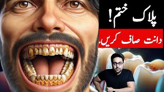 Dr ZeeTop Remedy To get rid of Dental Plaque TARTAR  डॉक्टर ज़ी [upl. by Estas]