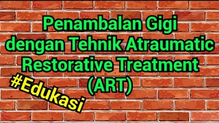 Penambalan Gigi dengan Tehnik ART Edukasi [upl. by Taddeo25]