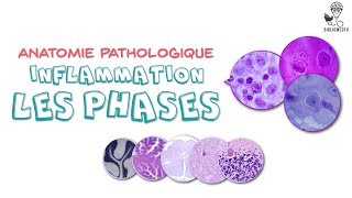 Anatomie Pathologique  Phases de lInflammation [upl. by Hartzel]