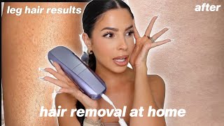 I TRIED LASER HAIR REMOVAL AT HOME this is what happened [upl. by Aneroc]