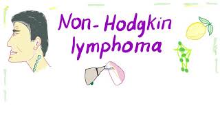 NonHodgkins lymphoma NHL Bcell and Tcell  Aggressive and Indolent [upl. by Notnel]