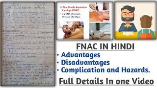 FNAC  fine needle aspiration cytology [upl. by Veljkov206]