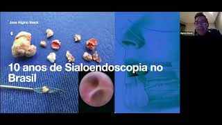 10 Anos de Sialoendoscopia no Brasil [upl. by Bohs]