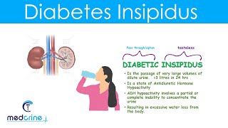 Diabetes Insipidus DI Causes Symptoms Diagnosis and treatment [upl. by Roxanna689]