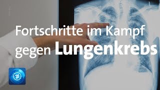 Fortschritte im Kampf gegen Lungenkrebs [upl. by Abita]