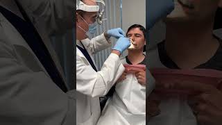 Nasal splint removal 7 days after a septoplastyno discomfort [upl. by Justino]