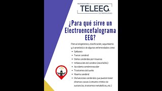 En qué consiste un electroencefalograma [upl. by Dorina]