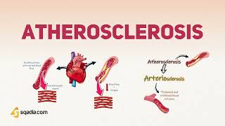 Atherosclerosis Physiology Pathophysiology and Pathogenesis [upl. by Ailaza]