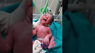 First cry baby at birthmaa shortvideo baby cutebaby status babyvideos cute nurse touching [upl. by Abramson]