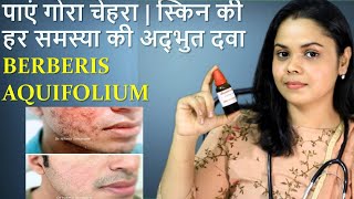 Berberis Aquifolium Homeopathic medicine for fairness acne pimples problems [upl. by Hoisch783]