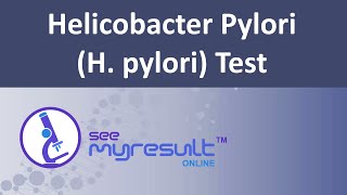 Helicobacter Pylori H pylori Test [upl. by Kyred]