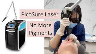 My PicoSure Experience bye bye freckles and pigmentations How does PicoSure laser works [upl. by O'Mahony]