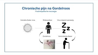 Chronische pijn na Gordelroos [upl. by Wooldridge113]