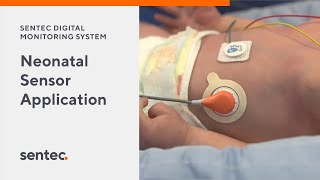 Neonatal Sensor Application for the Sentec Digital Transcutaneous Monitoring System [upl. by Seys963]