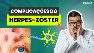 Quais as complicações e sequelas do HerpesZóster [upl. by Hnirt100]