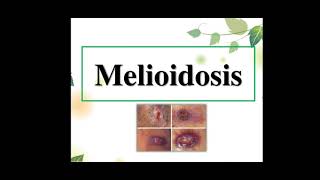 Melioidosis [upl. by Elbertina]