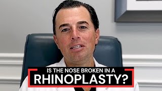 What is Osteotomy During Rhinoplasty Nose Job Surgery  Dr Anthony Corrado [upl. by Aznecniv]