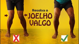 Corrija o JOELHO PARA DENTRO  teoria  exercícios para melhorar joelho valgo [upl. by Proctor891]