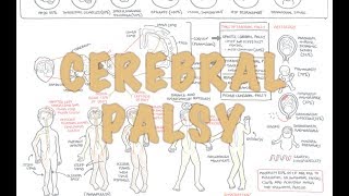 Cerebral Palsy  DETAILED Overview [upl. by Kristel393]