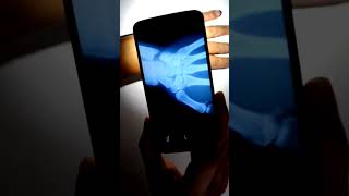 xray vision camera app  xray apps download [upl. by Epilef]