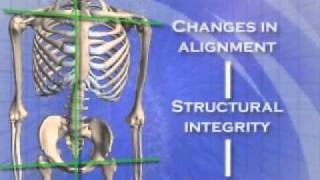 About the Atlas Orthogonal procedure [upl. by Owades799]