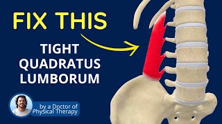 Is a Tight QL Causing Your Back Pain  Quadratus Lumborum Muscle Tightness [upl. by Anirtac]