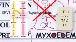 L3 hypothyroidism etiology part 1 [upl. by Anelhtak]