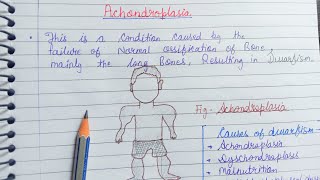 Achondroplasia Generalised bone disorders [upl. by Idel]