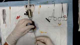 Orchidectomy surgery preformed by Dr Bowen [upl. by Stine]