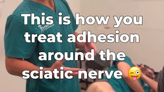 chiropractor PTs amp MTs  This is How to Treat Adhesion Around the Sciatic Nerve [upl. by Ulphiah759]