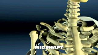 Clavicle Fractures [upl. by Oigres]