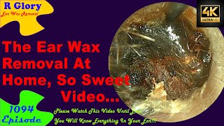 The Ear Wax Removal At Home Sweet Video Relaxing😍New Video Ear Wax Removal 1094 ear newvideo [upl. by Rosanna]