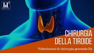 Chirurgia della tiroide [upl. by Ayalahs]