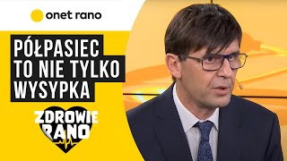 Zdrowie Rano Półpasiec to nie tylko wysypka [upl. by Ullund]