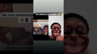 Put your teeth in 🤣🤣🤣 entertainment dentition viralshorts couple friends [upl. by Killarney895]