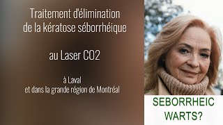 Traitement délimination de la kératose séborrhéique à Laval et dans la grande région de Montréal [upl. by Brinn564]