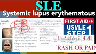 Systemic lupus erythematous SLE in HindiUrdu by first aid for USMLE step 1 [upl. by Nanfa792]