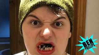 Teeth whitening disaster PRANK [upl. by Alyks953]