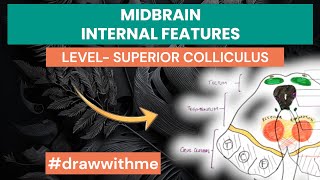 Midbrain Cross Sectional Anatomy  Internal features  level of Superior Colliculus [upl. by Aldarcie]