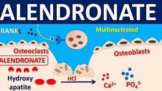 Alendronate for osteoporosis  Mechanism side effects precautions amp uses [upl. by Astra109]